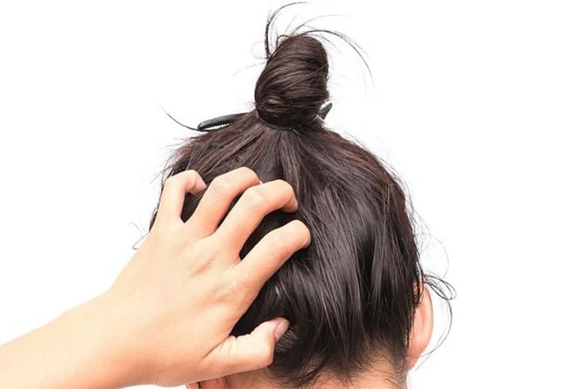 بهترین درمان ریزش مو زنان | بهترین قرص ضد ریزش مو برای زنان