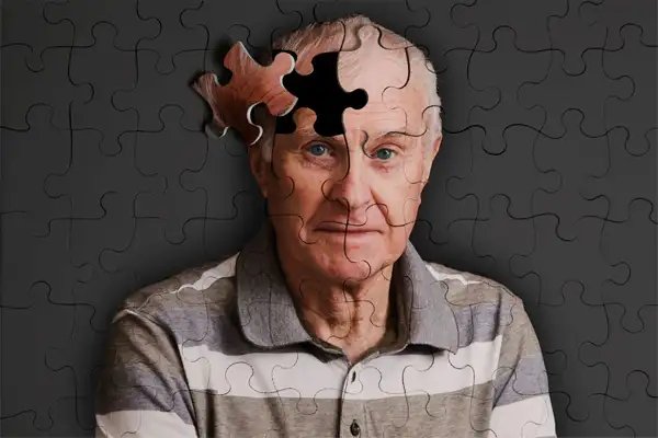 آلزایمر شدید چیست؟ | افرادی که آلزایمر می گیرند چقدر زنده می ماند