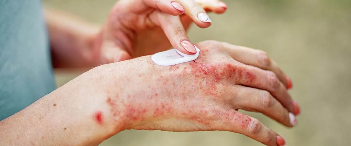 نحوه استفاده صحیح از چیتو سیلکر