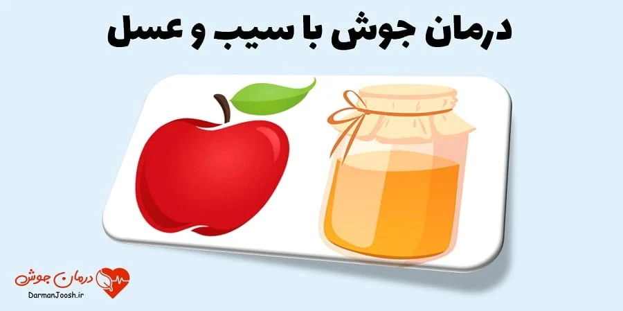 عمومی