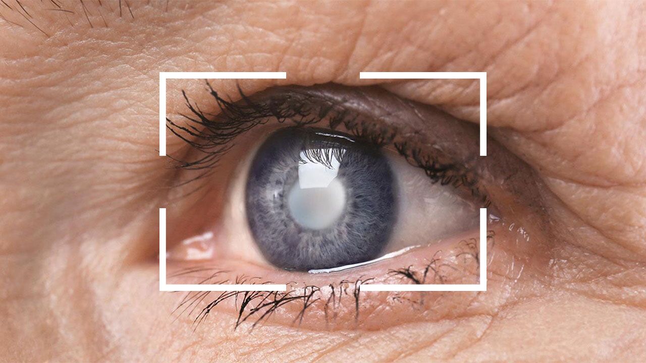 لیزر عوارض شدید چشمی دیابت را کاهش می‌دهد؟