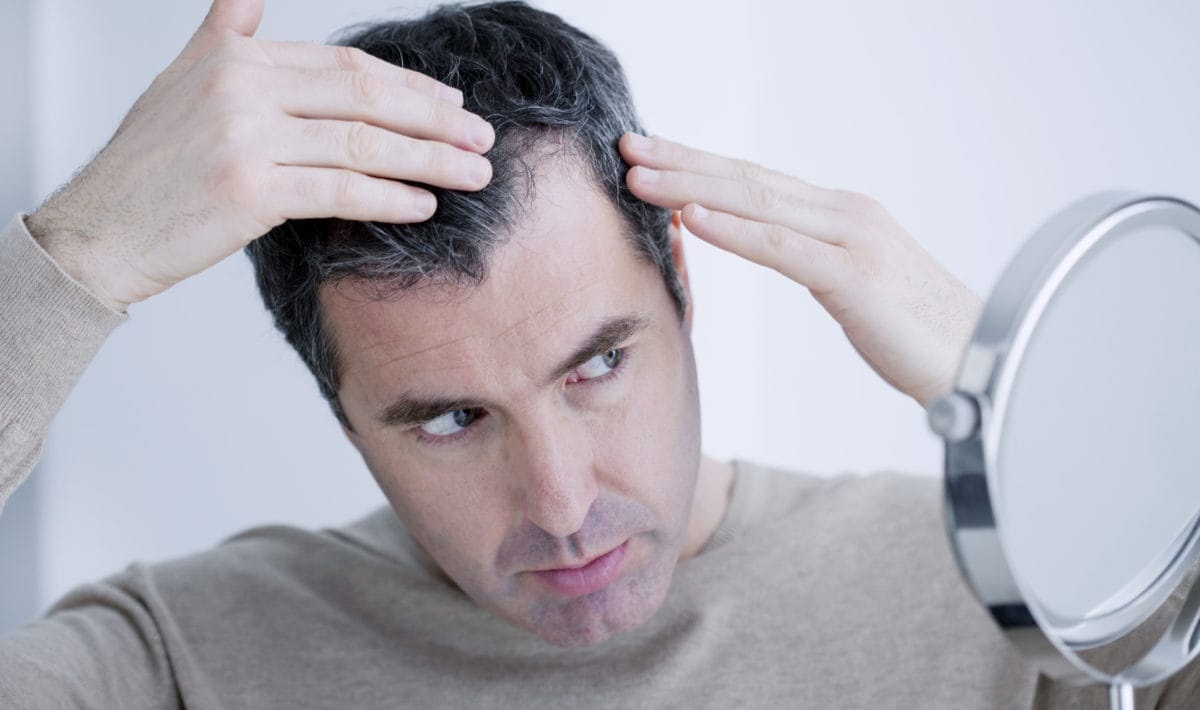Prevent hair loss in men