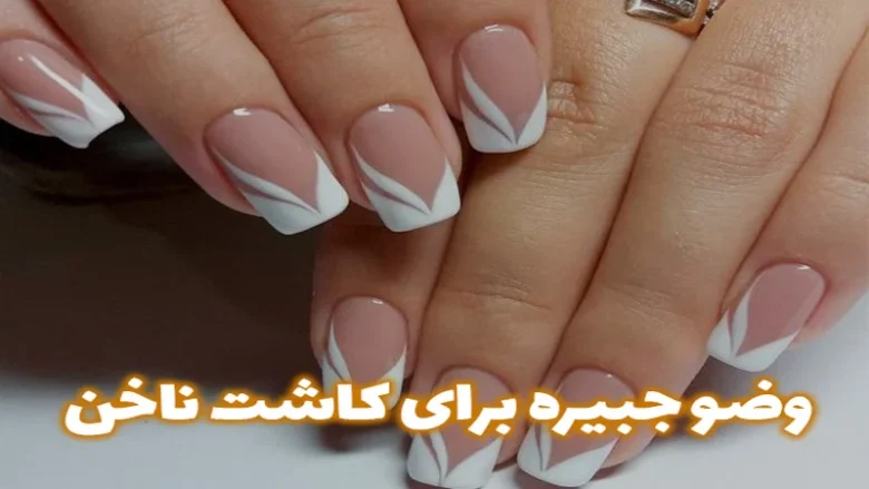 کاشت ناخن