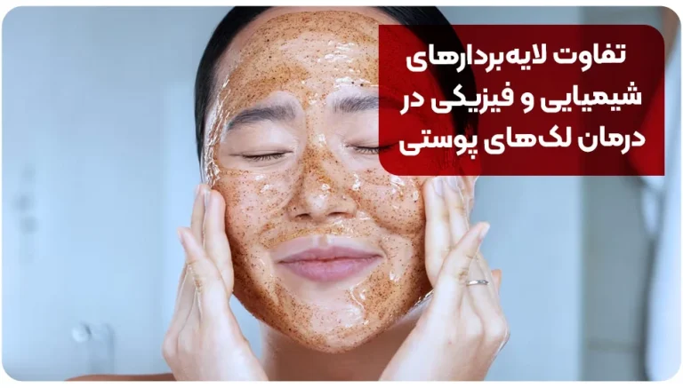 تفاوت لایه‌بردارهای شیمیایی و فیزیکی در درمان لک‌های پوستی