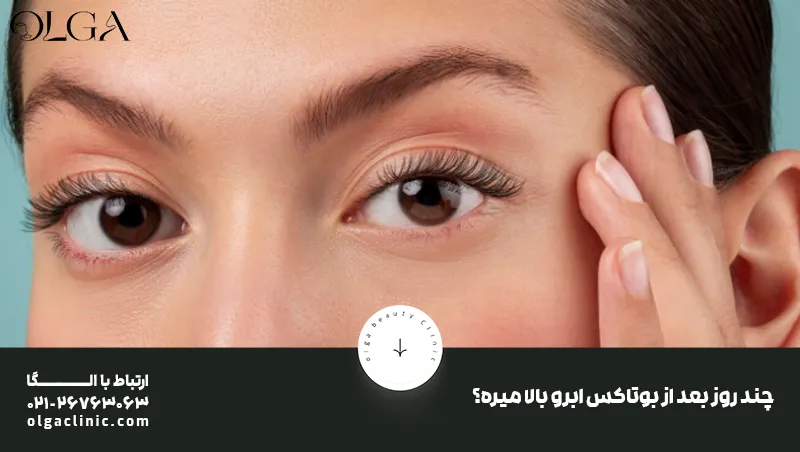 چند روز بعد از بوتاکس ابرو بالا میره؟
