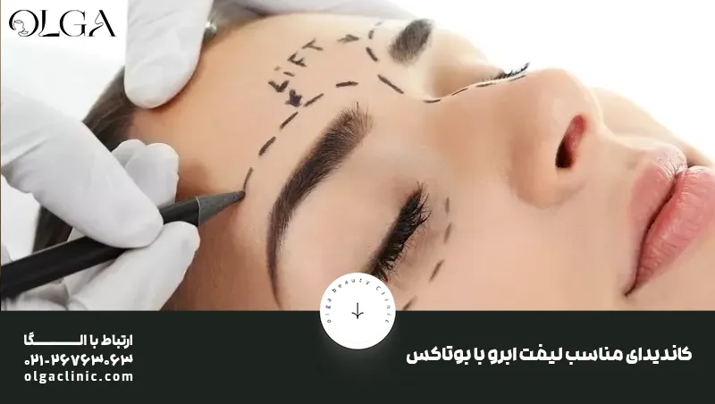 کاندیدای مناسب لیفت ابرو با بوتاکس